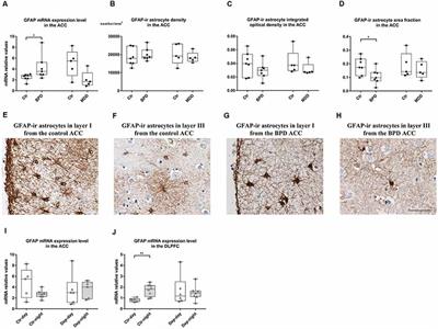 Astrocyte Changes in the Prefrontal Cortex From Aged Non-suicidal Depressed Patients